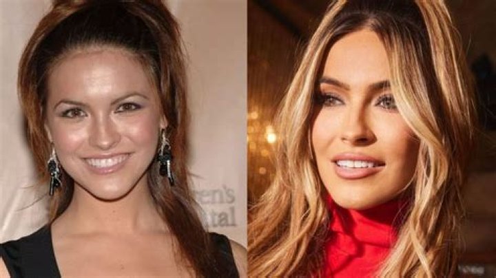 Chrishell Stause Before and After Plastic Surgery: No Makeup Look of the Selling Sunset Alum Examined!
