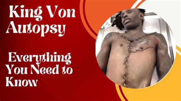 Unraveling The Mystery Of King Von's Autopsy: What Really Happened?
