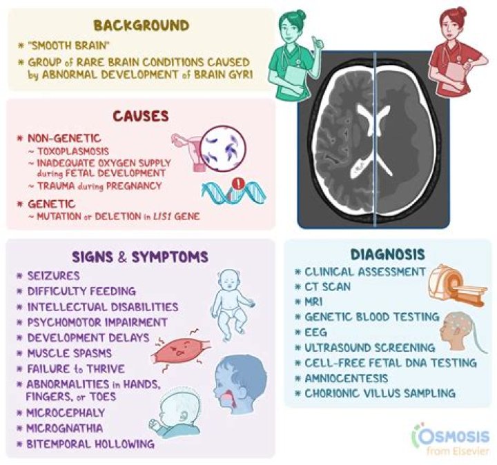 What Happened To Pastor Chad Veach Daughter Georgia Veach? Lissencephaly Diagnosis And Health Update